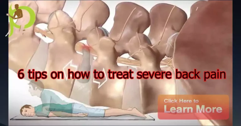 How to treat severe back pain